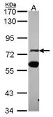 Anti-ZNF74 antibody [C1C3] used in Western Blot (WB). GTX114892