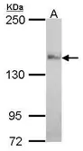 Anti-Nardilysin antibody [C2C3], C-term used in Western Blot (WB). GTX114899