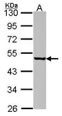 Anti-EIF4A1 antibody [N2C2], Internal used in Western Blot (WB). GTX114910