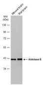 Anti-Aldolase B antibody used in Western Blot (WB). GTX114914