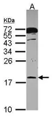 Anti-RPB8 antibody [N1C3] used in Western Blot (WB). GTX114917
