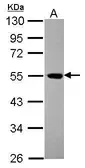 Anti-EIF5 antibody used in Western Blot (WB). GTX114923