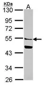 Anti-MGAT2 antibody [N1C1] used in Western Blot (WB). GTX114926