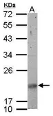 Anti-SNRPN antibody used in Western Blot (WB). GTX114927