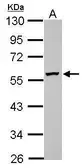 Anti-DPH2 antibody used in Western Blot (WB). GTX114929
