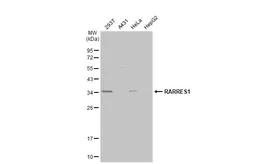 Anti-RARRES1 antibody [N2C3] used in Western Blot (WB). GTX114937