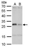 Anti-HLA-DMA antibody used in Western Blot (WB). GTX114939