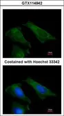 Anti-TIMP4 antibody [N1C3] used in Immunocytochemistry/ Immunofluorescence (ICC/IF). GTX114942