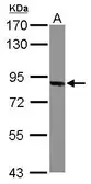 Anti-Thimet Oligopeptidase antibody [C1C3] used in Western Blot (WB). GTX114946