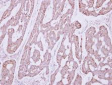 Anti-Occludin antibody used in IHC (Paraffin sections) (IHC-P). GTX114949