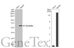 Anti-Occludin antibody used in Western Blot (WB). GTX114949