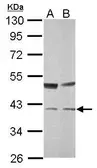 Anti-Transaldolase antibody [N2C3] used in Western Blot (WB). GTX114956