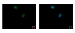 Anti-ELK3 antibody [N1C2] used in Immunocytochemistry/ Immunofluorescence (ICC/IF). GTX114966