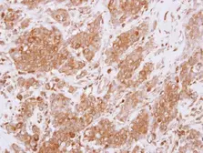 Anti-RGS10 antibody used in IHC (Paraffin sections) (IHC-P). GTX114973