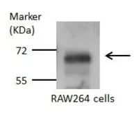 Anti-Glutaminase antibody [C1C3] used in Western Blot (WB). GTX114982