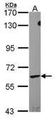 Anti-LTA4H antibody [N3C3] used in Western Blot (WB). GTX114986