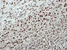 Anti-CSTF2 antibody [N1N2], N-term used in IHC (Paraffin sections) (IHC-P). GTX114994