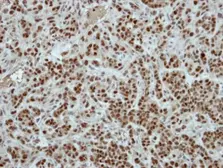 Anti-ZNF187 antibody [N3C3] used in IHC (Paraffin sections) (IHC-P). GTX114997
