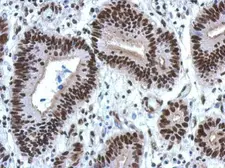 Anti-hnRNP M antibody [N1N2], N-term used in IHC (Paraffin sections) (IHC-P). GTX114999