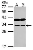 Anti-IMPA1 antibody used in Western Blot (WB). GTX115007