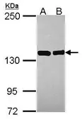 Anti-Valyl tRNA synthetase antibody [N1N2], N-term used in Western Blot (WB). GTX115015