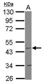 Anti-COX15 antibody [N3C3] used in Western Blot (WB). GTX115022
