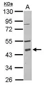 Anti-PDCD2 antibody [N2C3] used in Western Blot (WB). GTX115028