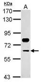 Anti-CP2c antibody used in Western Blot (WB). GTX115030