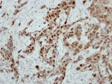 Anti-Ataxin 3 antibody used in IHC (Paraffin sections) (IHC-P). GTX115032