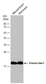Anti-Visinin-like 1 antibody used in Western Blot (WB). GTX115039