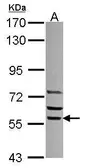Anti-SRP54 antibody used in Western Blot (WB). GTX115041