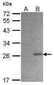 Anti-6X His tag antibody (HRP) used in Western Blot (WB). GTX115045-01
