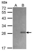 Anti-6X His tag antibody (HRP) used in Western Blot (WB). GTX115045-01