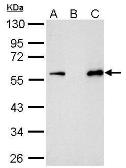 Anti-Myc tag antibody used in Immunoprecipitation (IP). GTX115046