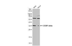 Anti-C/EBP delta antibody [N1C3] used in Western Blot (WB). GTX115047