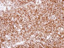 Anti-alpha Tubulin 1A antibody used in IHC (Paraffin sections) (IHC-P). GTX115048
