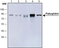 Anti-gamma Catenin antibody [15F11] used in Western Blot (WB). GTX11506