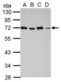 Anti-STAM antibody [N2C2], Internal used in Western Blot (WB). GTX115060