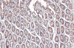 Anti-STAM antibody [N2C2], Internal used in IHC (Paraffin sections) (IHC-P). GTX115060