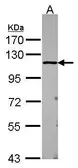 Anti-USP5 antibody [N1N3] used in Western Blot (WB). GTX115063