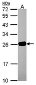 Anti-GS1 antibody used in Western Blot (WB). GTX115073