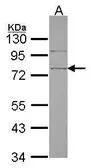 Anti-SRPX antibody [N3C3] used in Western Blot (WB). GTX115081