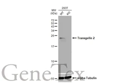 Anti-Transgelin 2 antibody [N1C3] used in Western Blot (WB). GTX115082