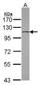Anti-DHX16 antibody [C1C3] used in Western Blot (WB). GTX115088