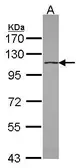 Anti-DHX16 antibody [C1C3] used in Western Blot (WB). GTX115088