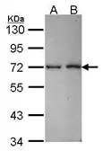 Anti-RanBP3 antibody [N3C2], Internal used in Western Blot (WB). GTX115096
