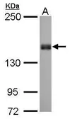Anti-Liprin alpha 1 antibody [N1N2], N-term used in Western Blot (WB). GTX115098