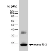 Anti-IL2 antibody [JES6-1A12] used in Western Blot (WB). GTX11510