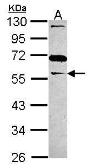 Anti-GAS7 antibody [N3C3] used in Western Blot (WB). GTX115101