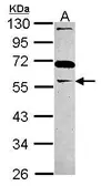 Anti-GAS7 antibody [N3C3] used in Western Blot (WB). GTX115101